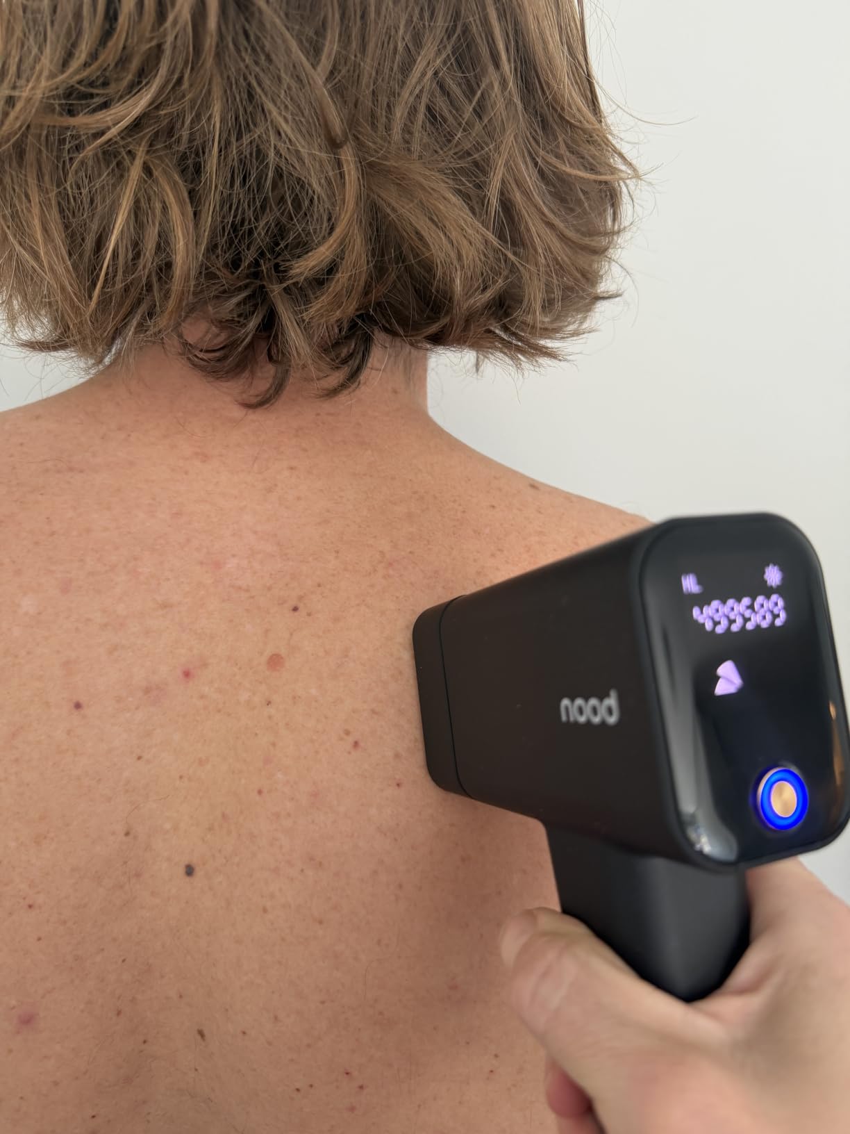 Nood Flasher Pro - Forbes Best Product 2026 - IPL Laser Hair Removal Device For At Home Use - Pain-Free, Permanent, Visible Results After First Use & Works Everywhere Hair Grows - Gloss White customer photo 1