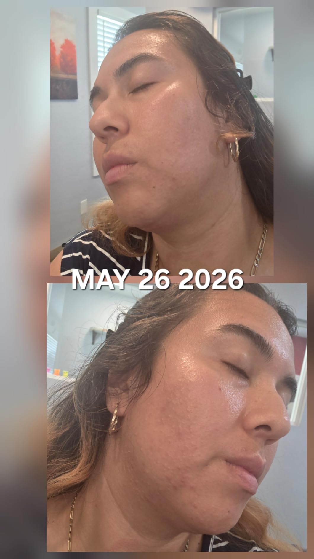 Paula's Choice SKIN PERFECTING 2% BHA Liquid Leave-On Exfoliant customer photo 1