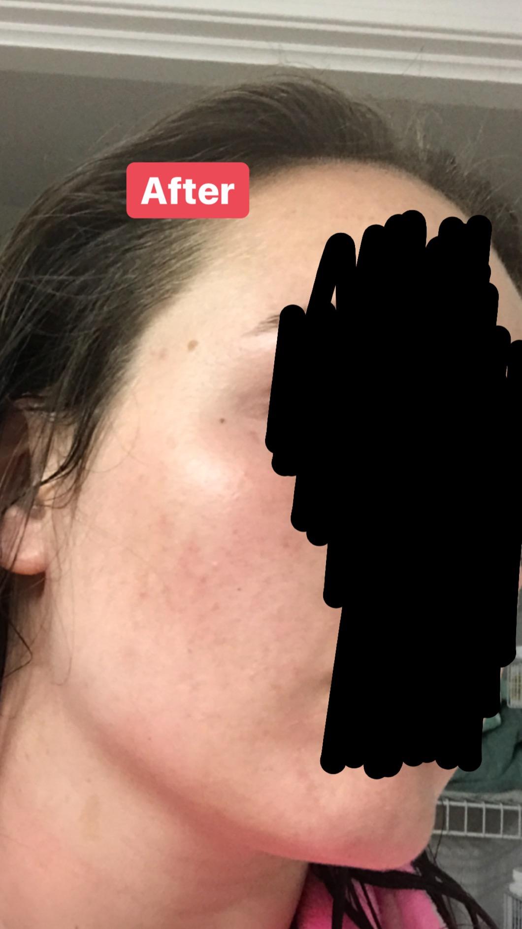 Mad Hippie Vitamin C Serum, Low Irritation, 1.02 Fl Oz customer photo 1