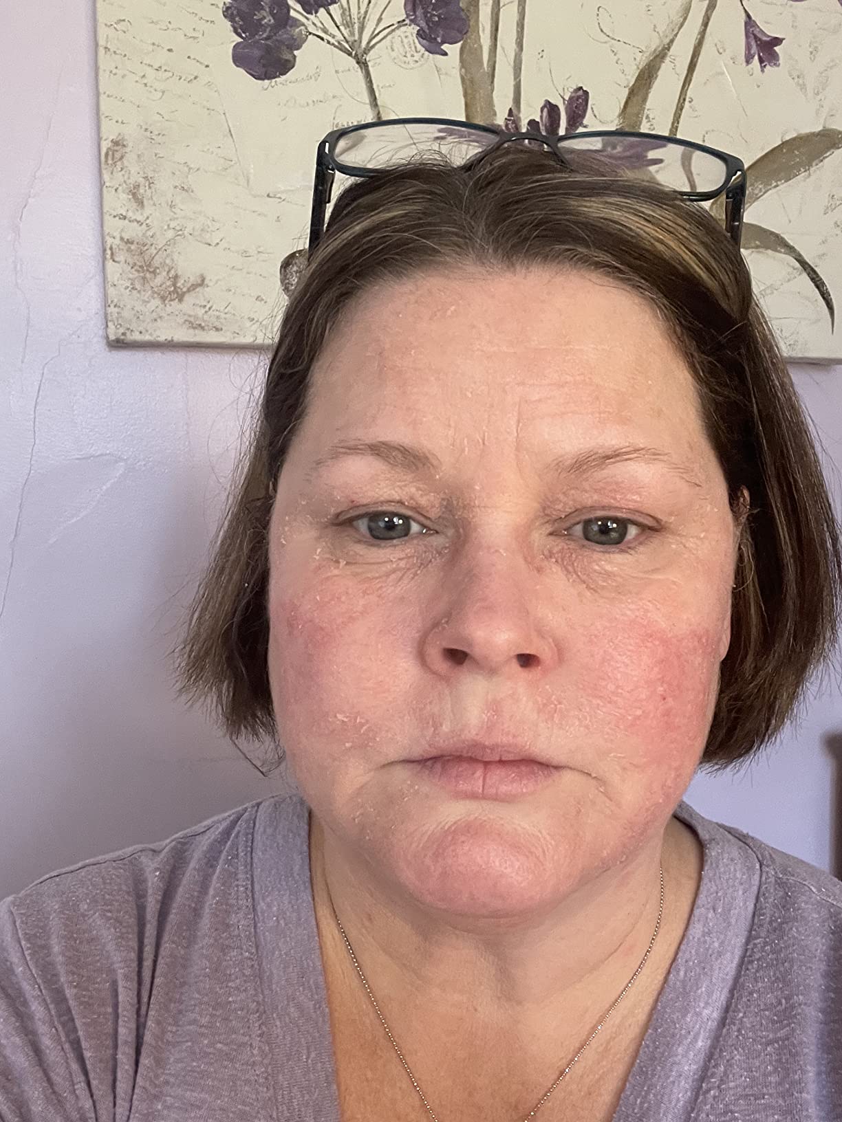 Paula's Choice CLINICAL 1% Retinol Face Treatment with Peptides customer photo 1