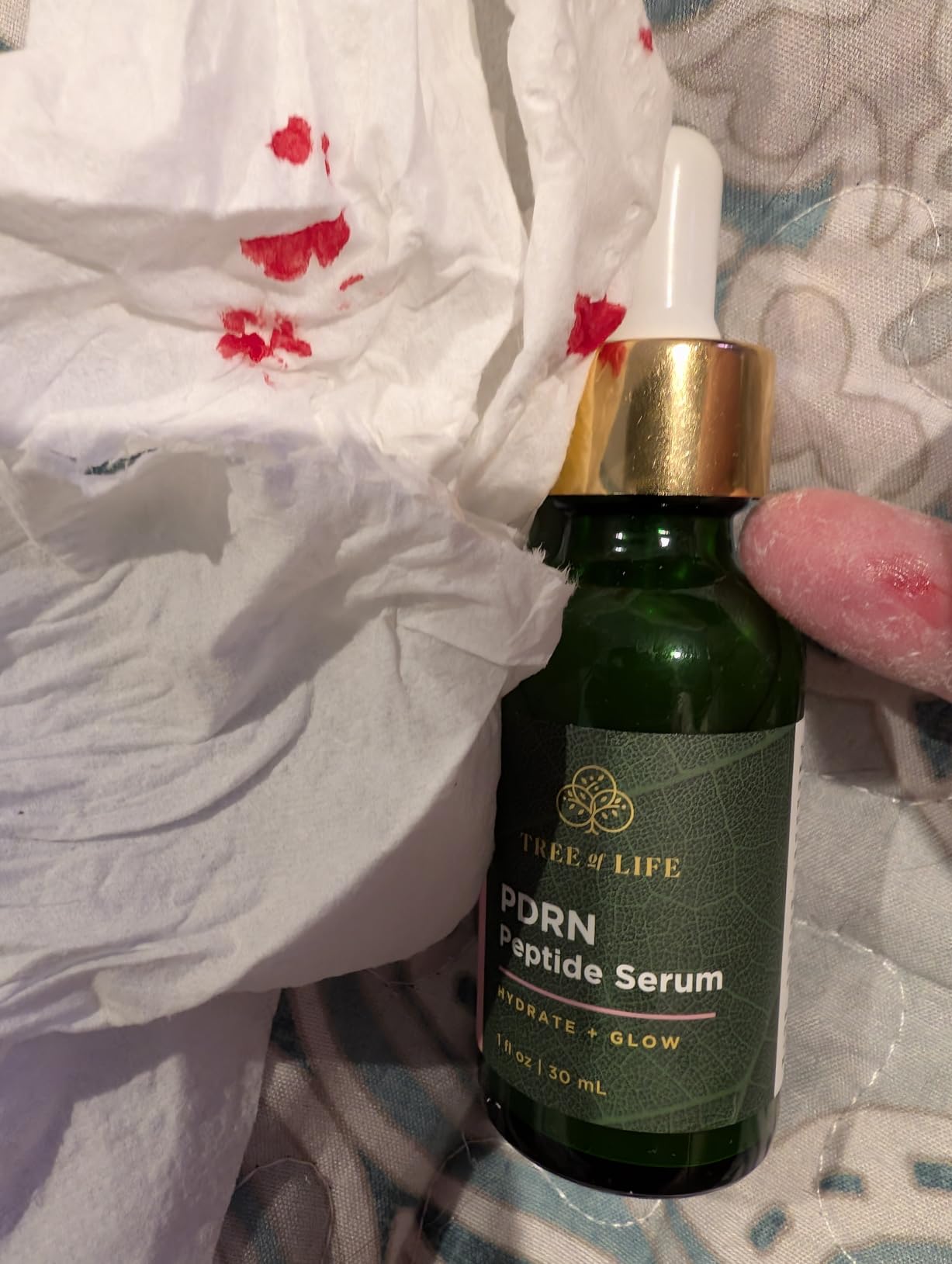 Tree of Life Retinol Serum for Face, Anti Aging Face Oil, 2 Fl Oz customer photo 2