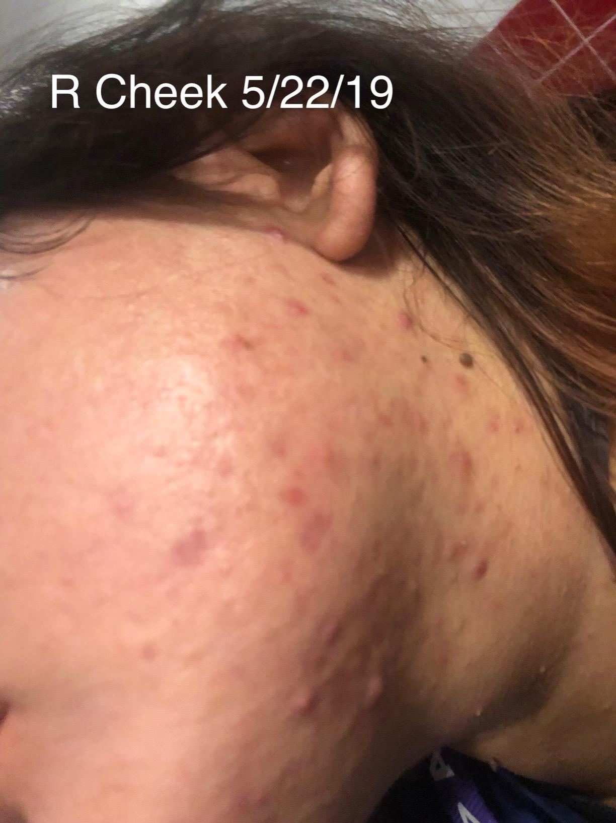 Eva Naturals Vitamin C Serum for Face with Retinol & Niacinamide, 1 oz customer photo 1