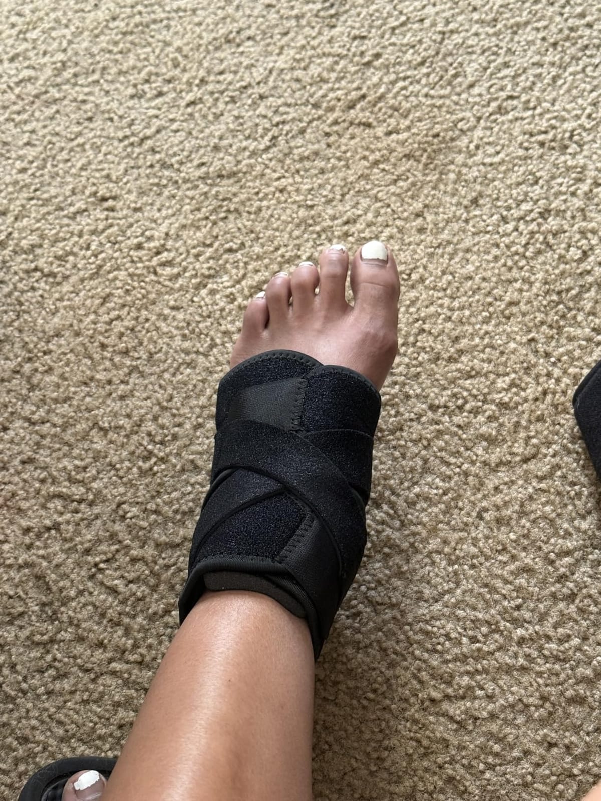 Bodyprox Ankle Support Brace, Breathable Adjustable Wrap, 1 Pack customer photo 1