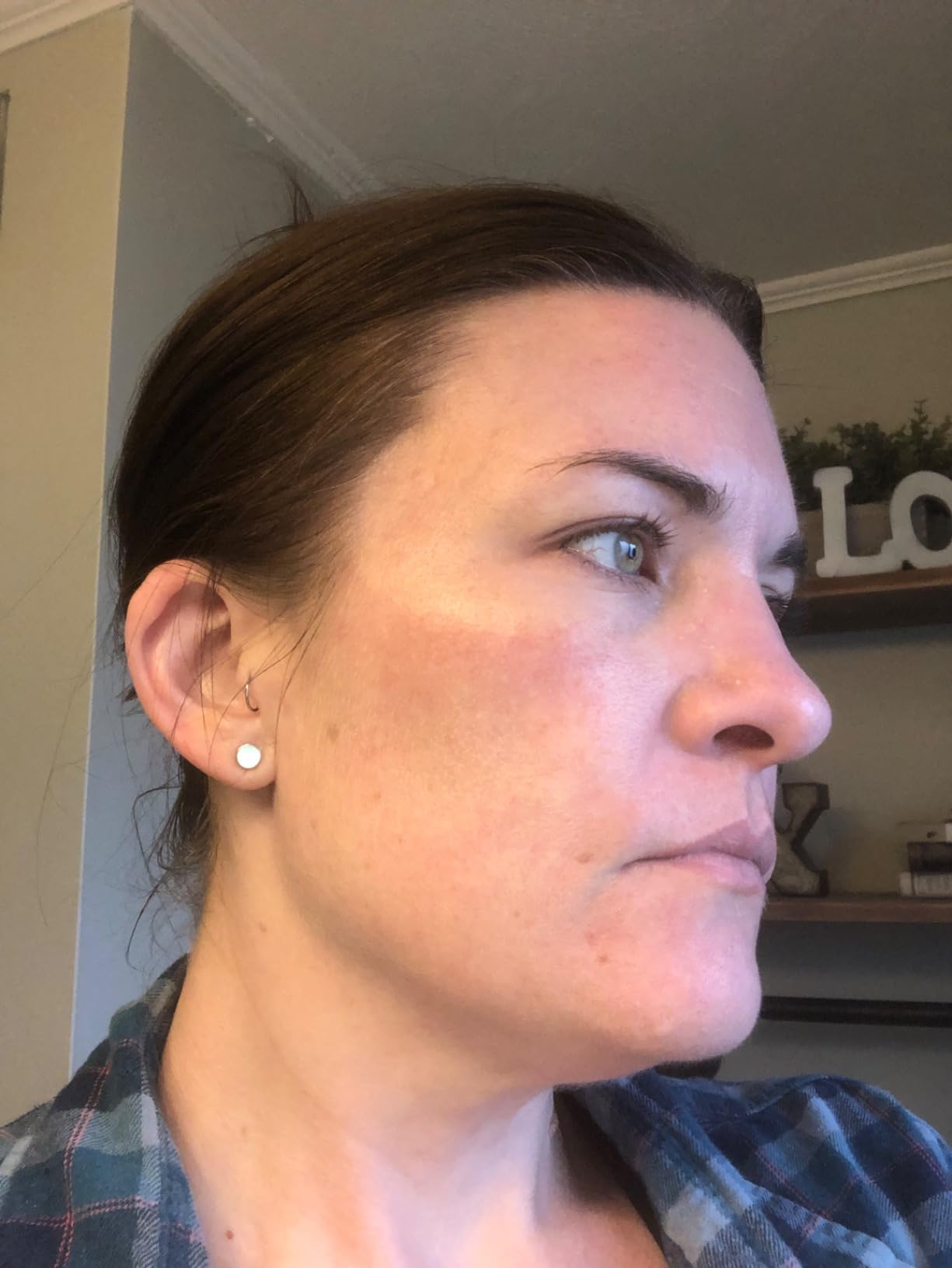 The Ordinary Retinol 0.5% in customer photo 2