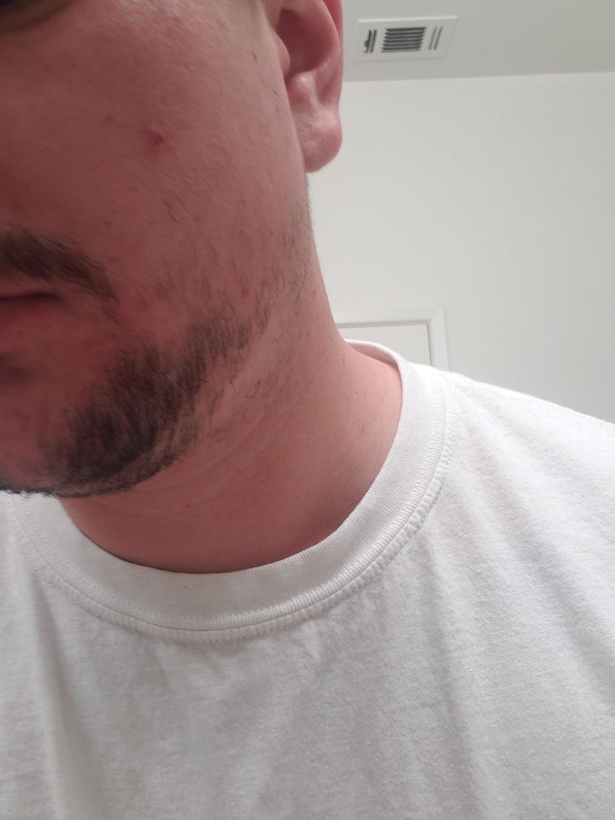 THICKGROW BIGBEARD Gummies - Get a Stronger, Longer, Thicker Beard Growth Formula for Men with Biotin, B12, and 10+ Elite Beard-Building Vitamins Nutrients 60 Cherry Flavored Gummies! customer photo 2
