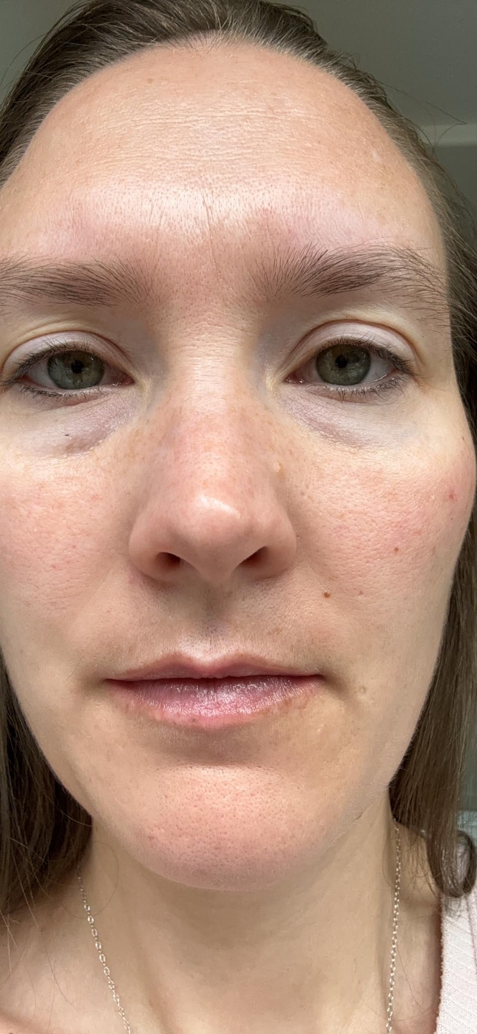 Paula's Choice CLEAR Oil-Free Lightweight Face Moisturizer customer photo 2