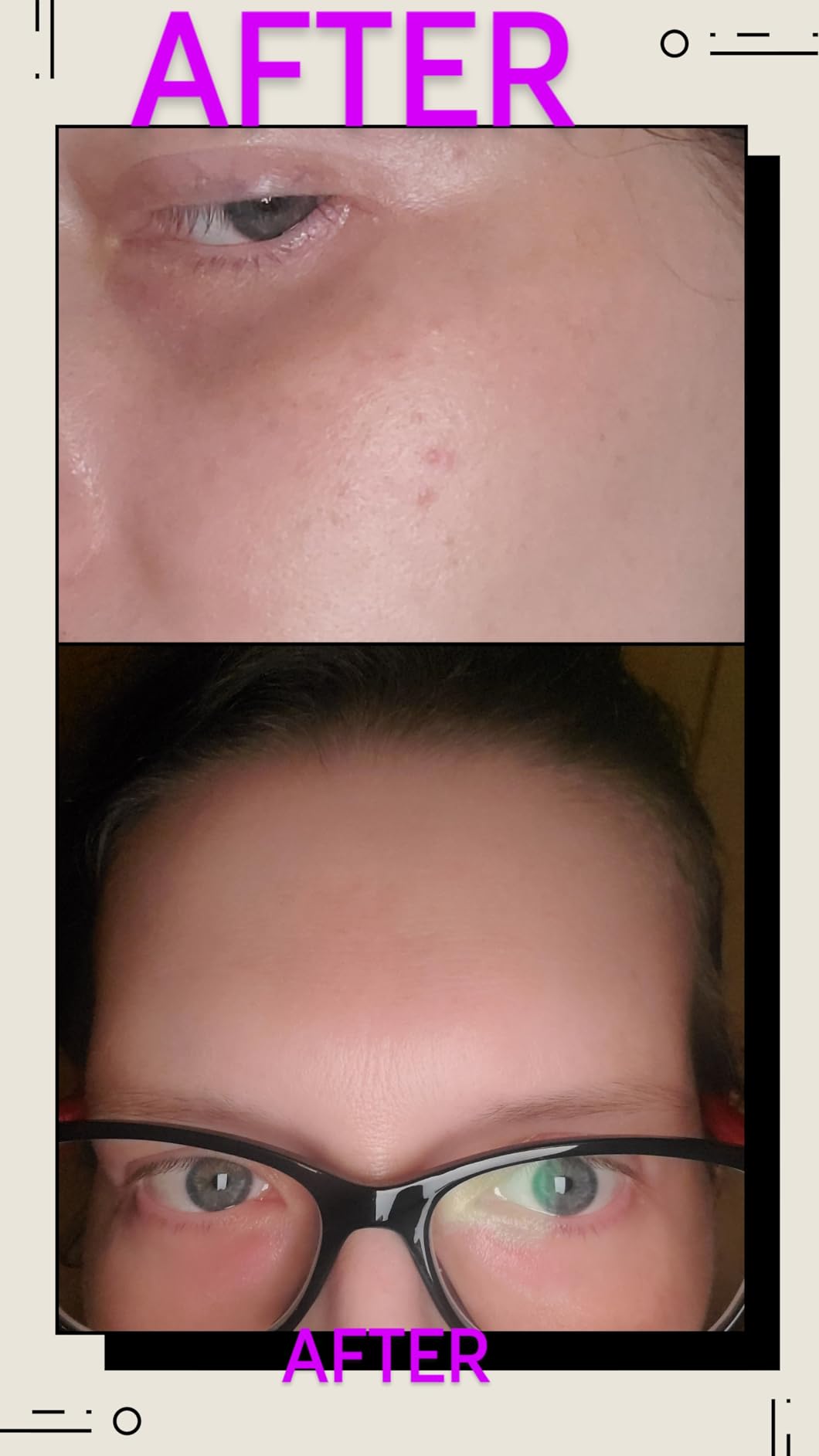 CeraVe Resurfacing Retinol Face Serum with Niacinamide, Pore Minimizer, 1oz | Skin Care Brightening Serum with Licorice Root, Acne Scar & Hyperpigmentation Treatment, Dark Spot Corrector, Skin Repair customer photo 1