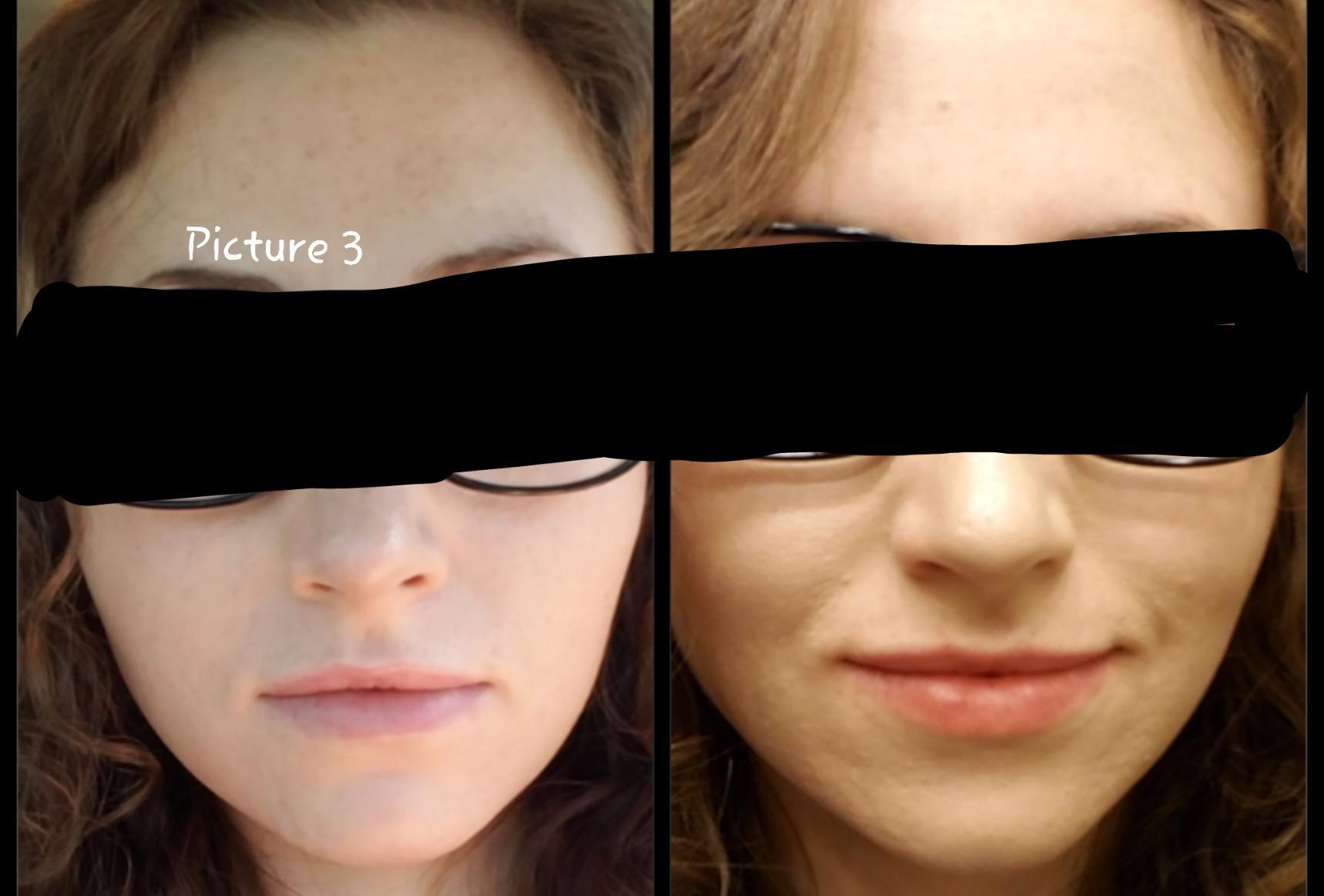 CeraVe Renewing Salicylic Acid Cleanser, Gentle Exfoliating Face Wash, 16oz customer photo 1