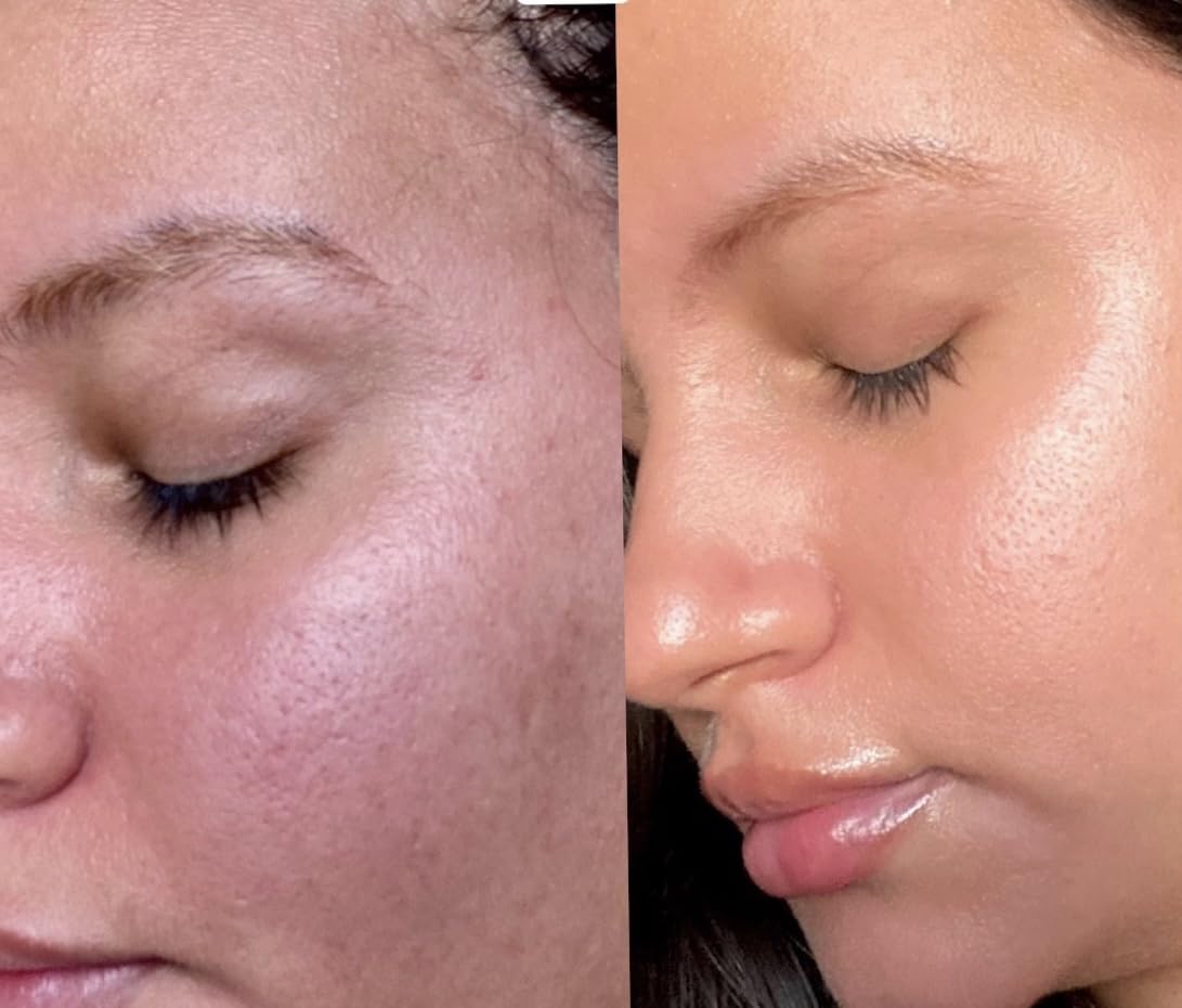 Murad Rapid Dark Spot Correcting Serum - Glycolic Acid - 1 Fl Oz customer photo 2