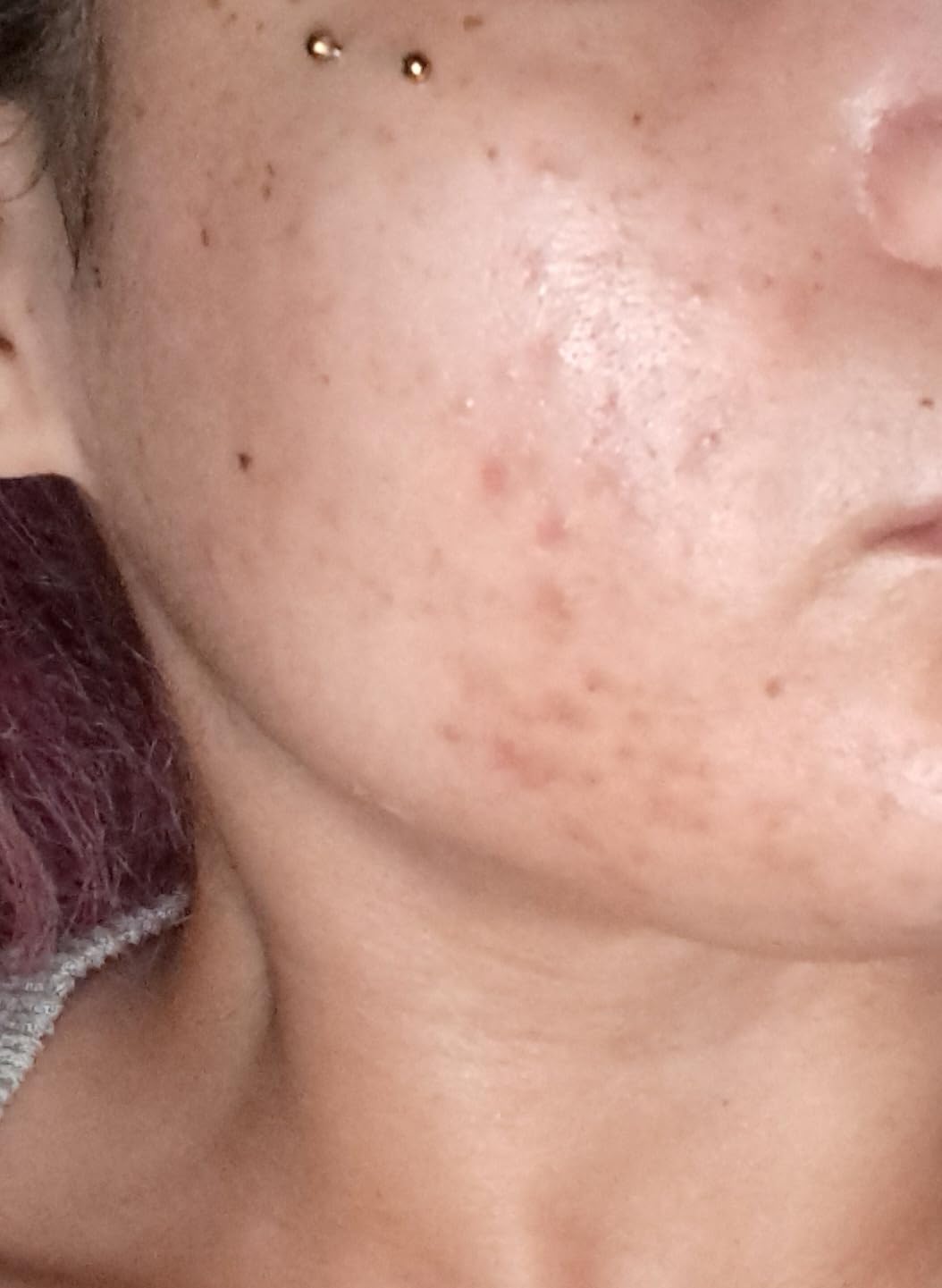 Good Molecules Discoloration Correcting Serum, Dark Spot Serum, 1 fl oz customer photo 1