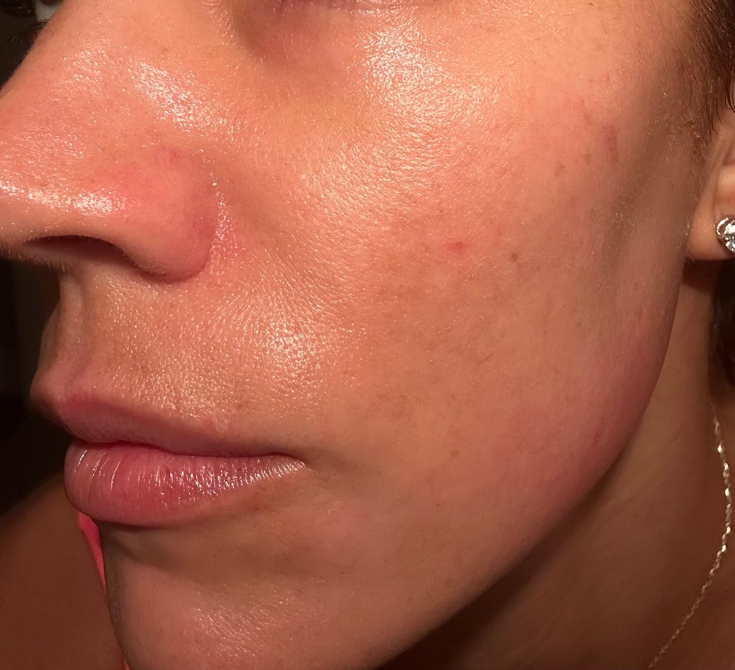 AXIS-Y Dark Spot Correcting Glow Serum - 5% Niacinamide Dark Spot Remover For Face - Vegan Korean Skin Care Niacinamide Serum for All Skin Types (1.69 fl. oz.) customer photo 2