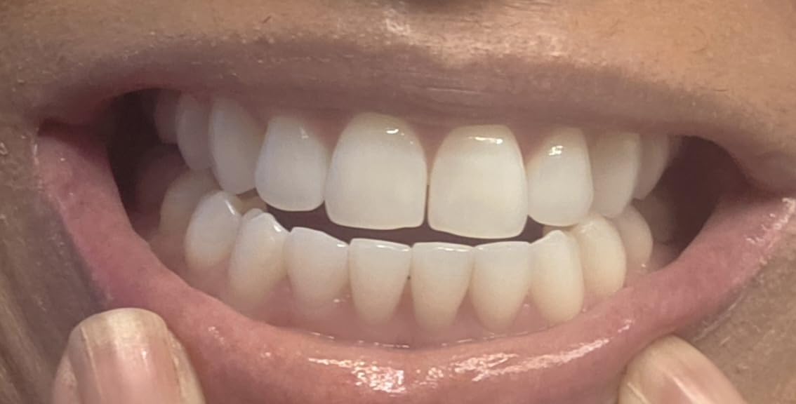 Crest 3D White Advanced, Teeth Whitening Toothpaste for Adults, 3.7 oz, 4 Pack, Cavity Protection Fluoride Toothpaste, Strengthens Enamel, Travel Size Toiletries customer photo 2