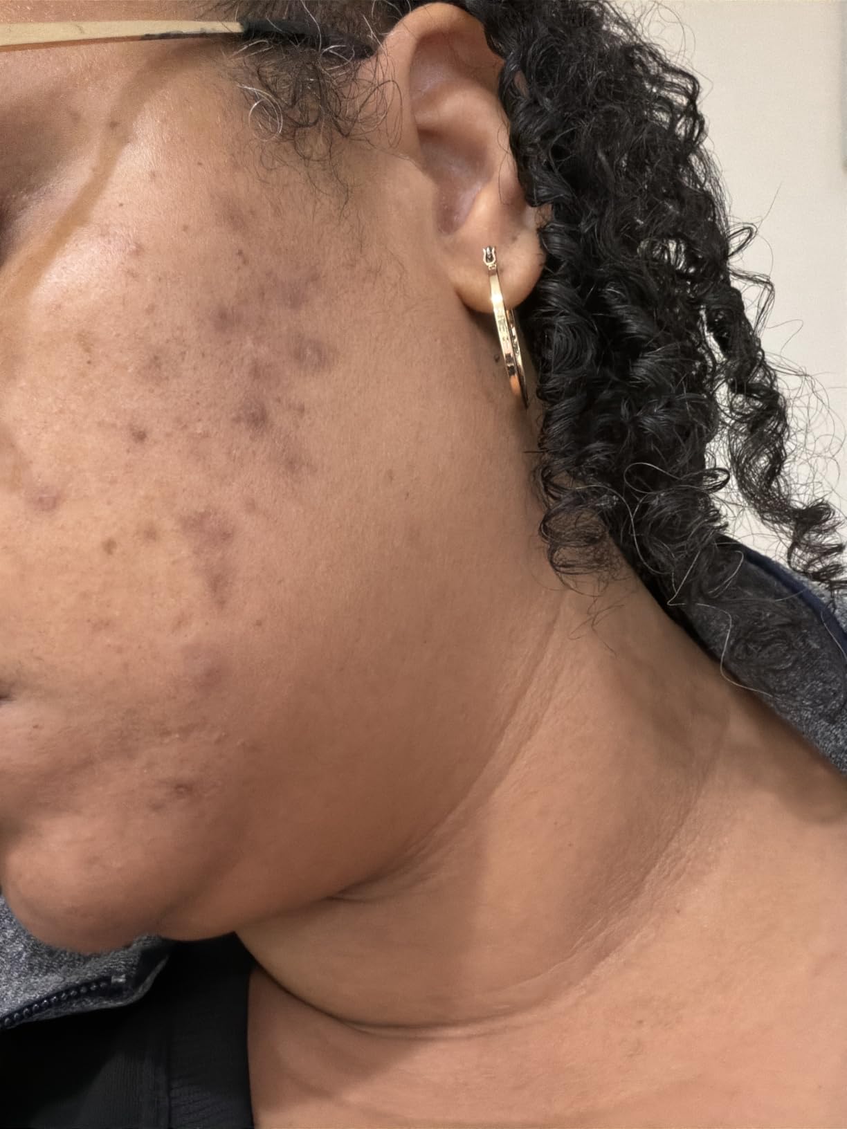Topicals, Faded Brightening Serum, Reduces Discoloration, 0.5 Fl Oz customer photo 1