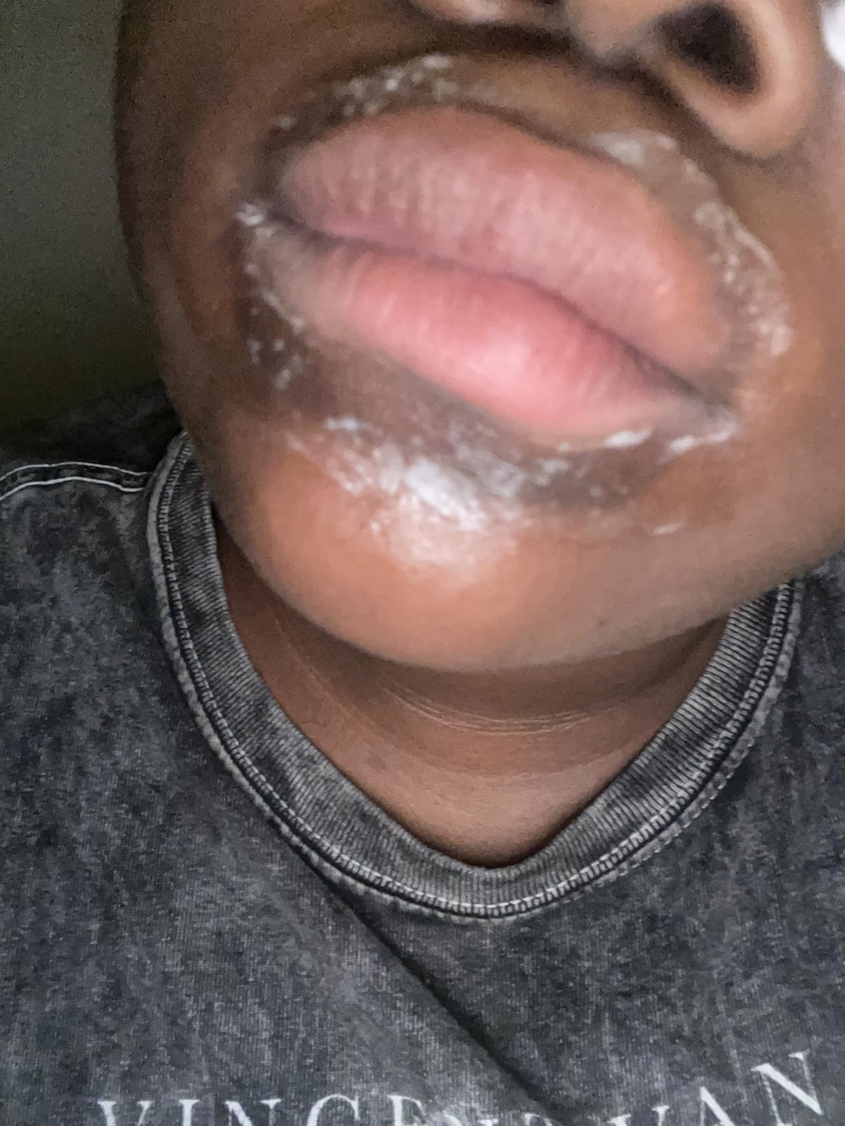 Ambi Even & Clear Advanced Fade Cream, Hydroquinone-free, Hyperpigmentation Treatment, Stubborn Dark Spot Corrector, Results In As Little As 2-3 Weeks, Niacinamide, Licorice Root Extract, PHA, 1 Fl Oz customer photo 1
