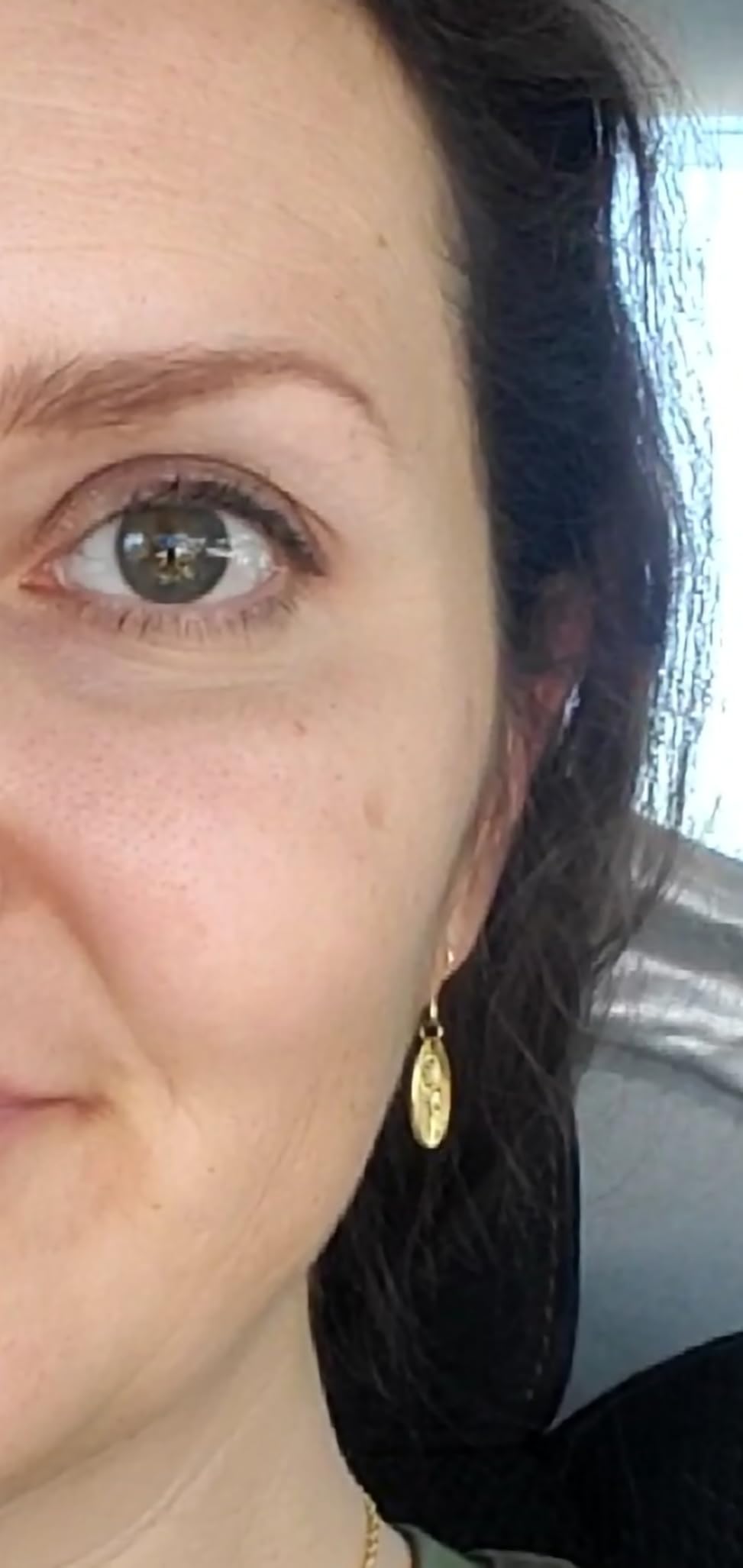 EnaSkin Dark Spot Corrector & Remover Serum for Face & Body, Niacinamide customer photo 1