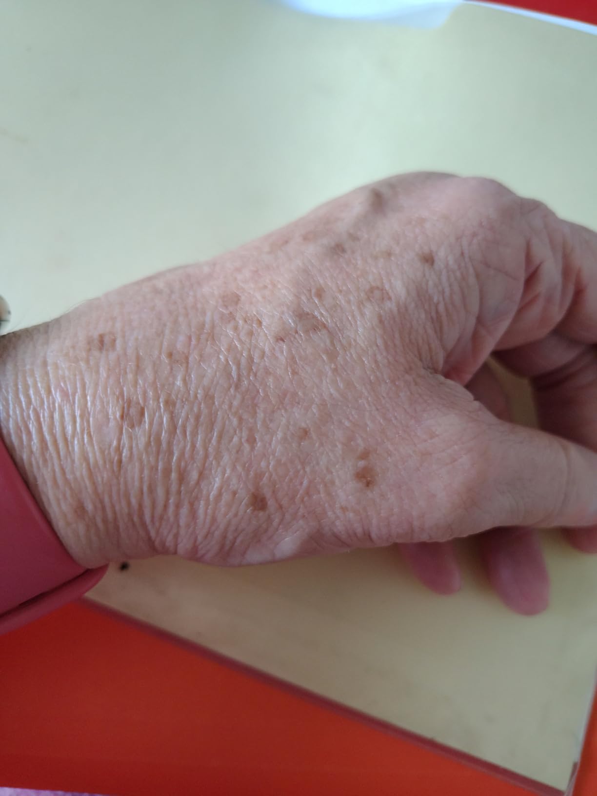 EnaSkin Dark Spot Corrector & Remover Serum for Face & Body, Niacinamide customer photo 2