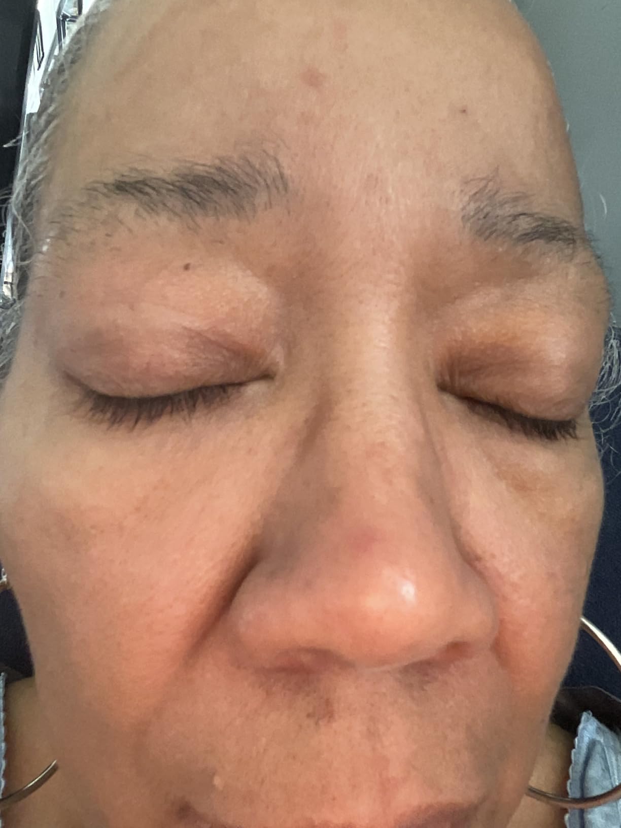 PanOxyl Acne Foaming Wash, 10% Benzoyl Peroxide, For Face & Body, 3 oz customer photo 2
