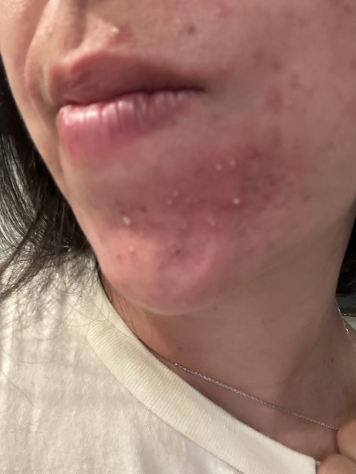 celimax Pore+Dark Spot Brightening Cream, 1.18 fl.oz customer photo 1