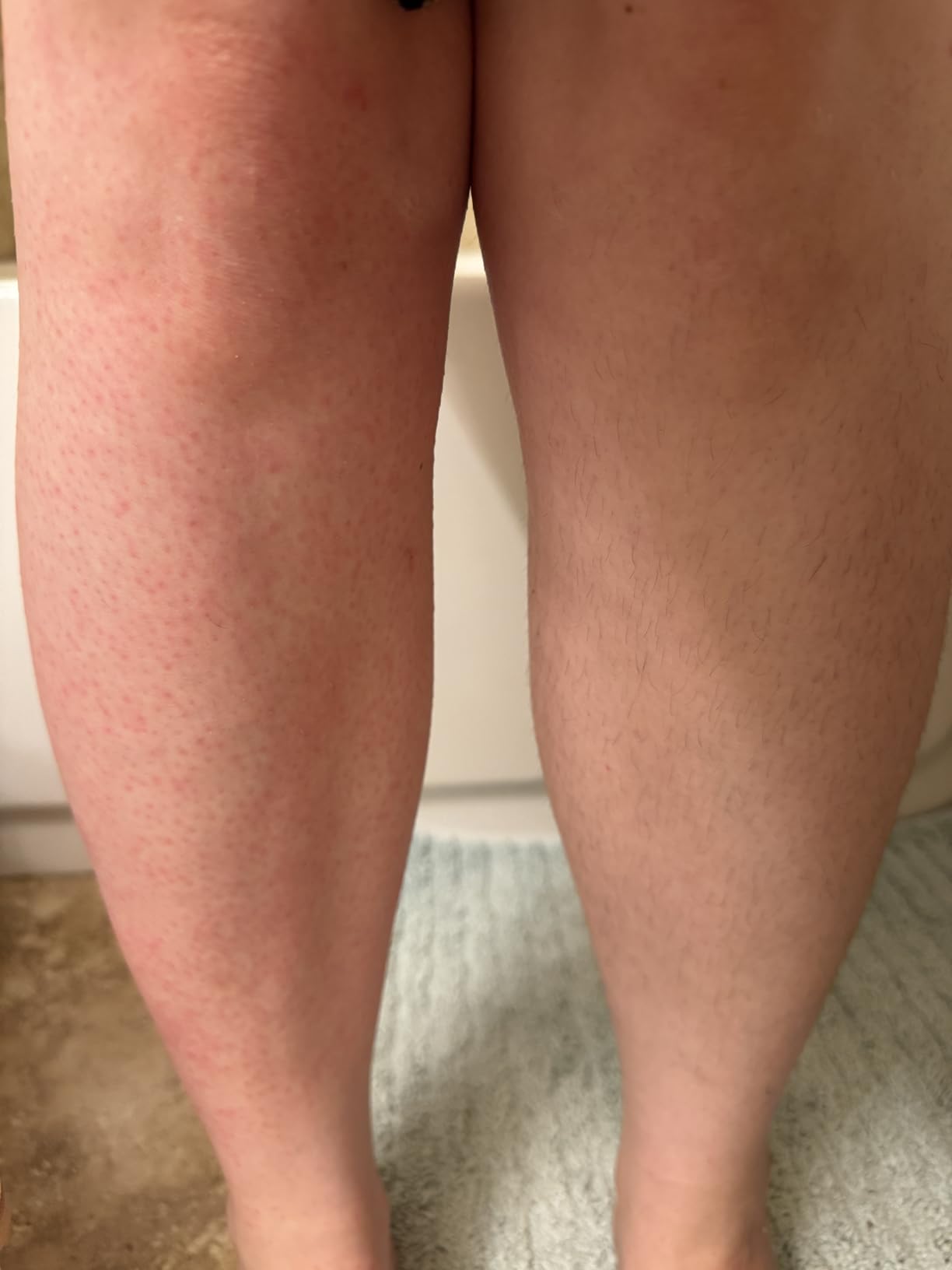 Philips Epilator Series 2000, Corded Epilator for Legs and Body, Hair Removal Device for Women, Model BRE227/00 customer photo 2