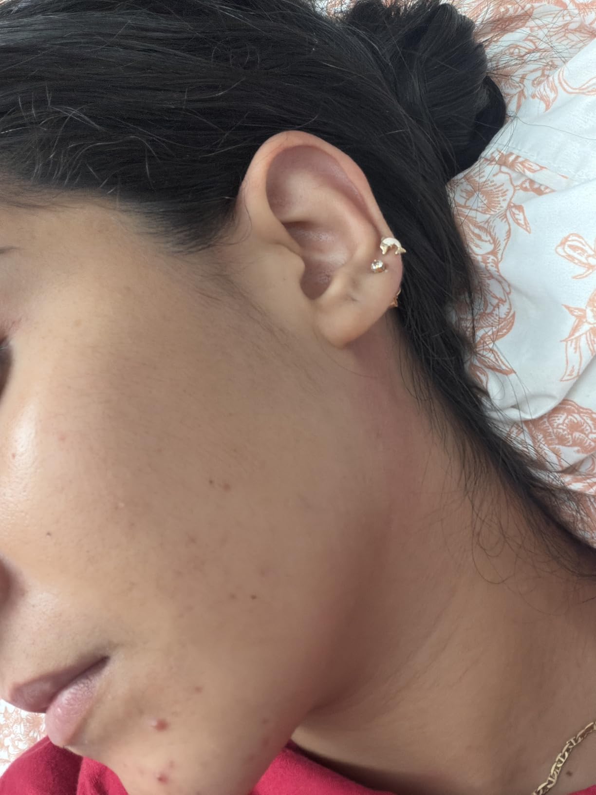 La Roche-Posay Effaclar Duo+M Salicylic Acid Acne Treatment for Face customer photo 2