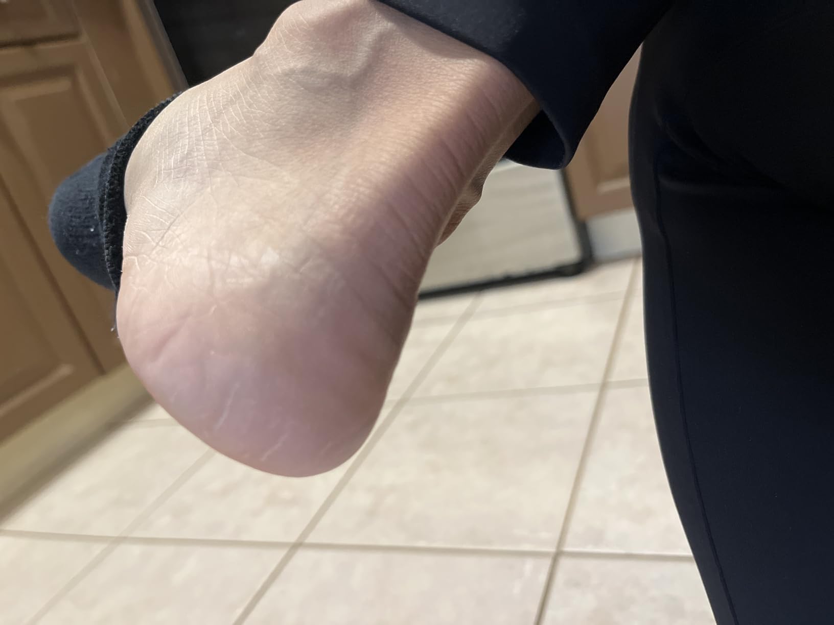 Probelle Double Sided Multidirectional Nickel Foot File Callus Remover - Immediately Reduces calluses and Corns to Powder for Instant Results, Safe Tool (Dark Grey) customer photo 2